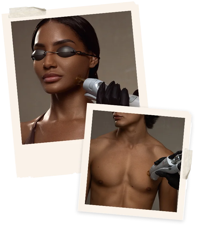 why choose sev laser hair removal services