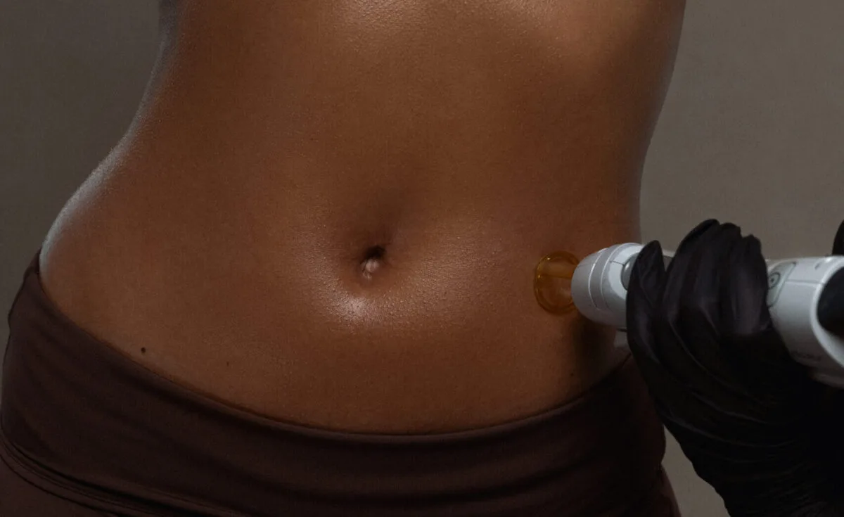 Does Laser Really Remove Hair Permanently?
