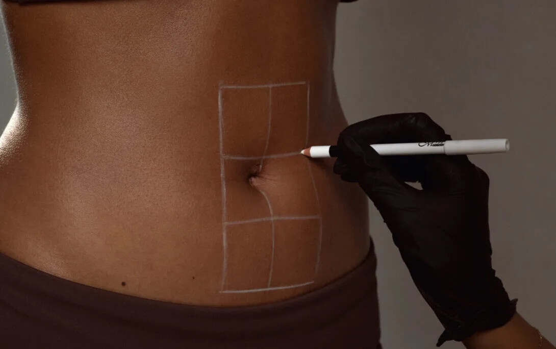 Why Am I Hairier After Laser Hair Removal?