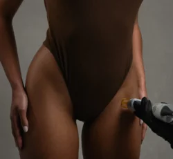 What Happens If You Stop Laser Hair Removal After 4 Sessions?