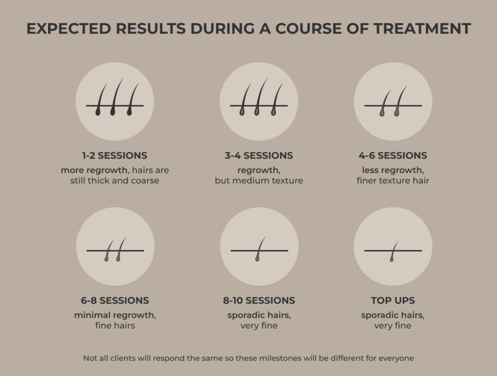 SEV laser hair removal sessions needed based on hair types