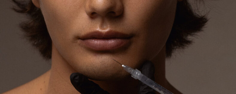 Lip Filler for Men: Everything You Need to Know