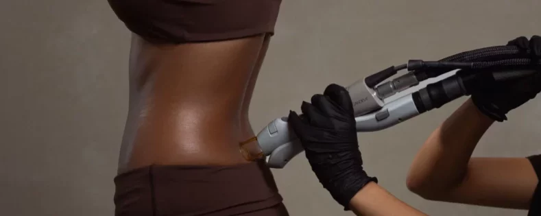 Laser Hair Removal for Dark Skin
