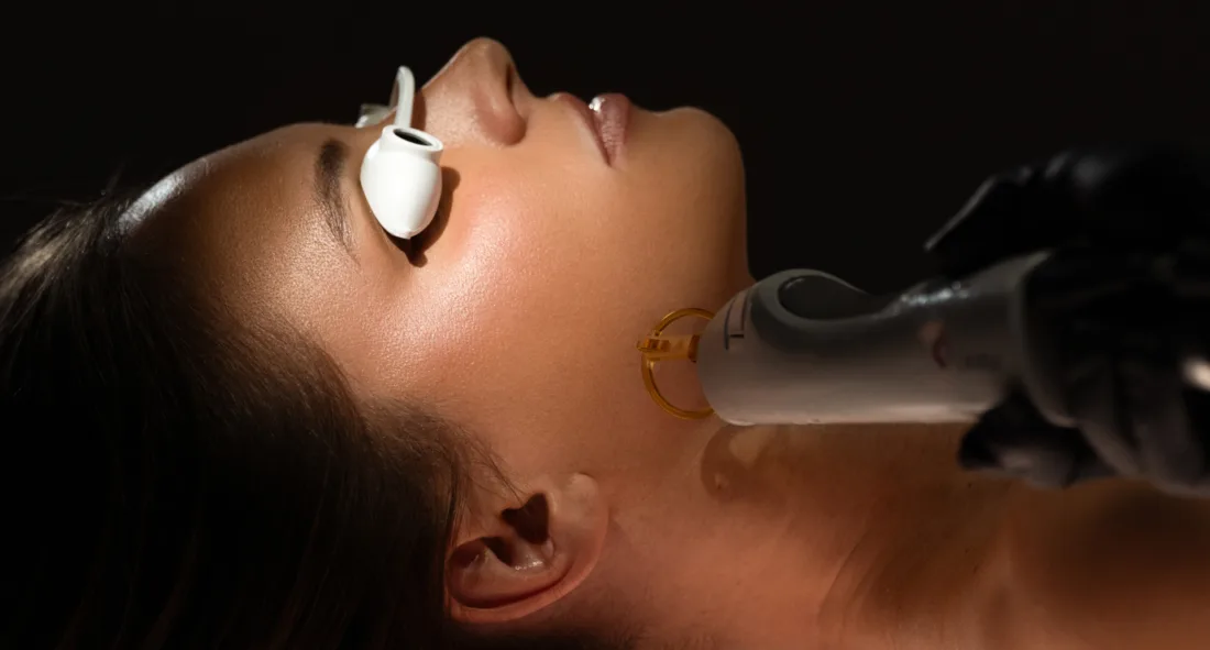 Laser Facial Treatment 101: A Complete Guide