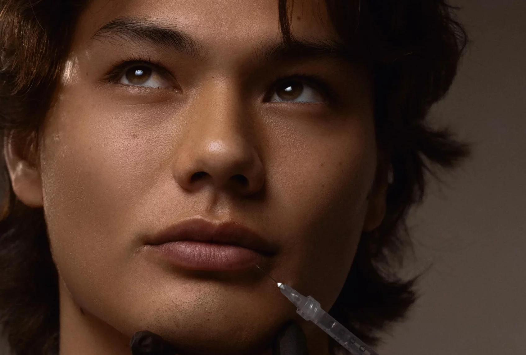 Botox for Marionette Lines | SEV