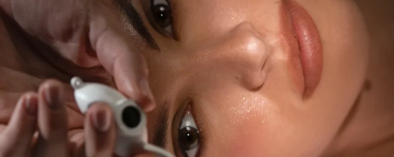 Laser Treatment for Wrinkles