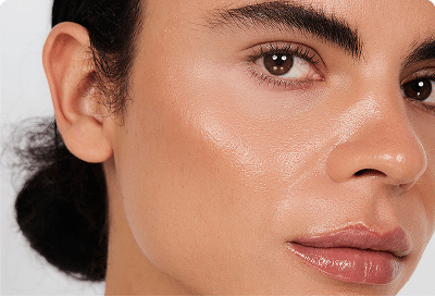 cheek fillers