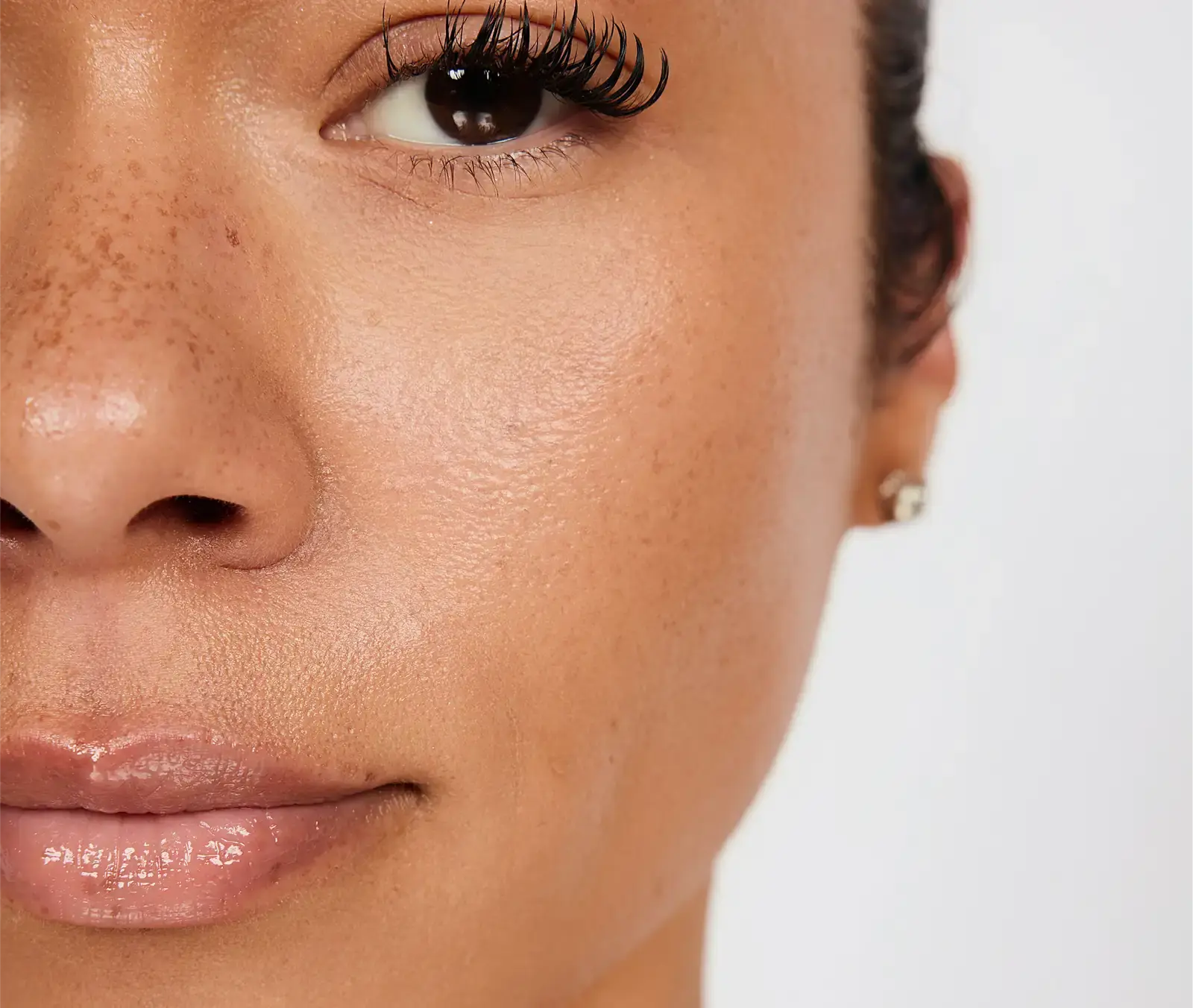 skinpen microneedling scars