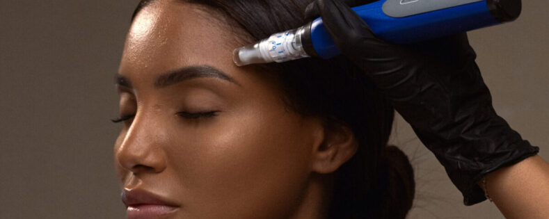 Benefits of SkinPen Microneedling