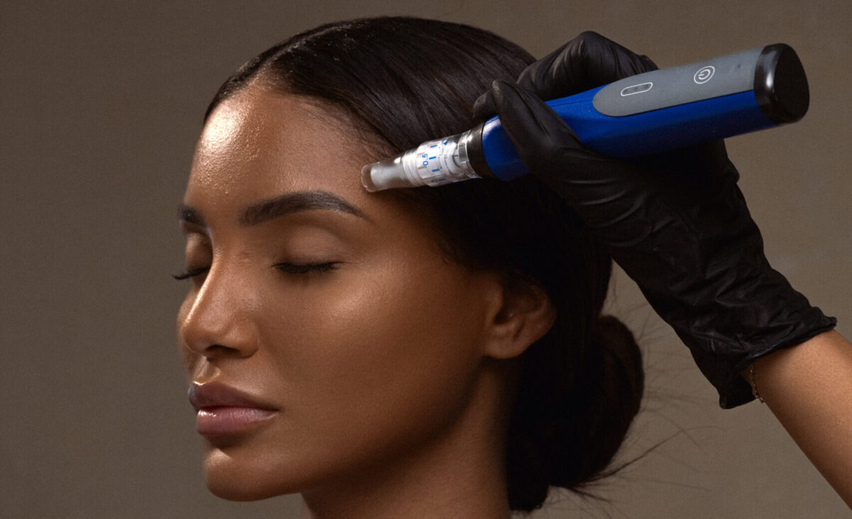 Benefits of SkinPen Microneedling