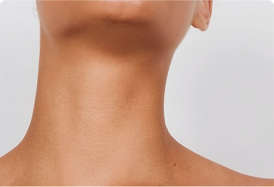 neck lift botox