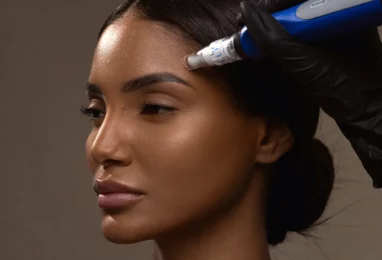 SkinPen Aftercare Guide