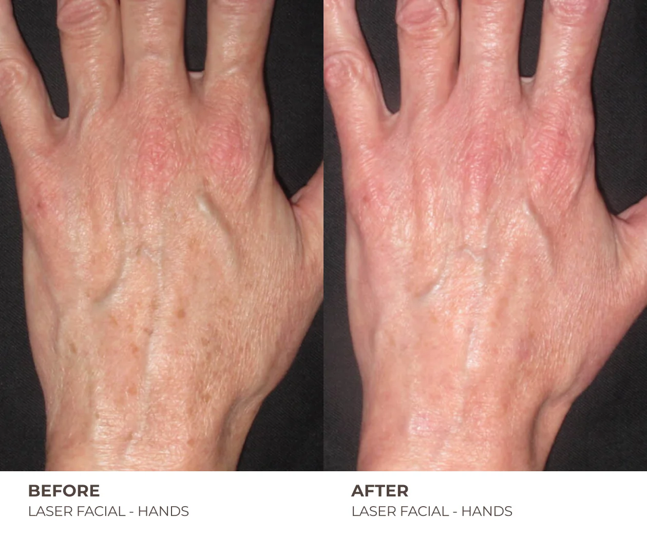 B&A_HOMEPAGE_03