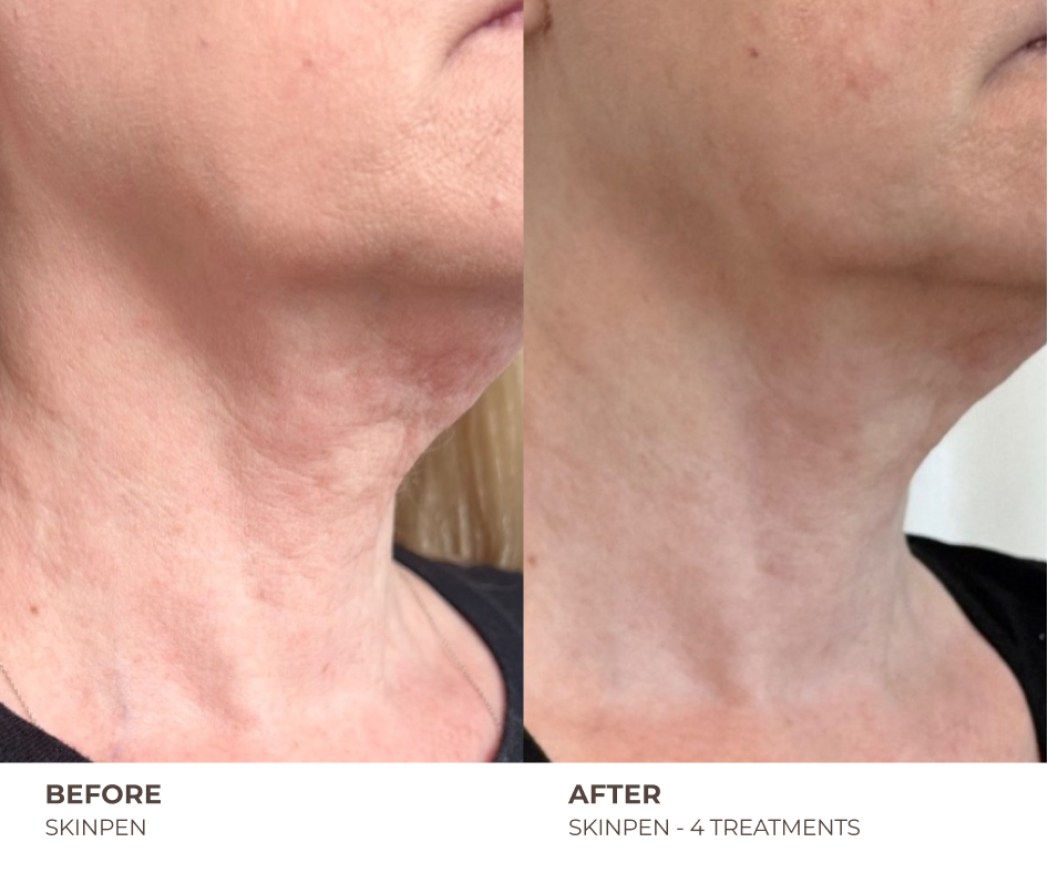 B&A_HOMEPAGE_04