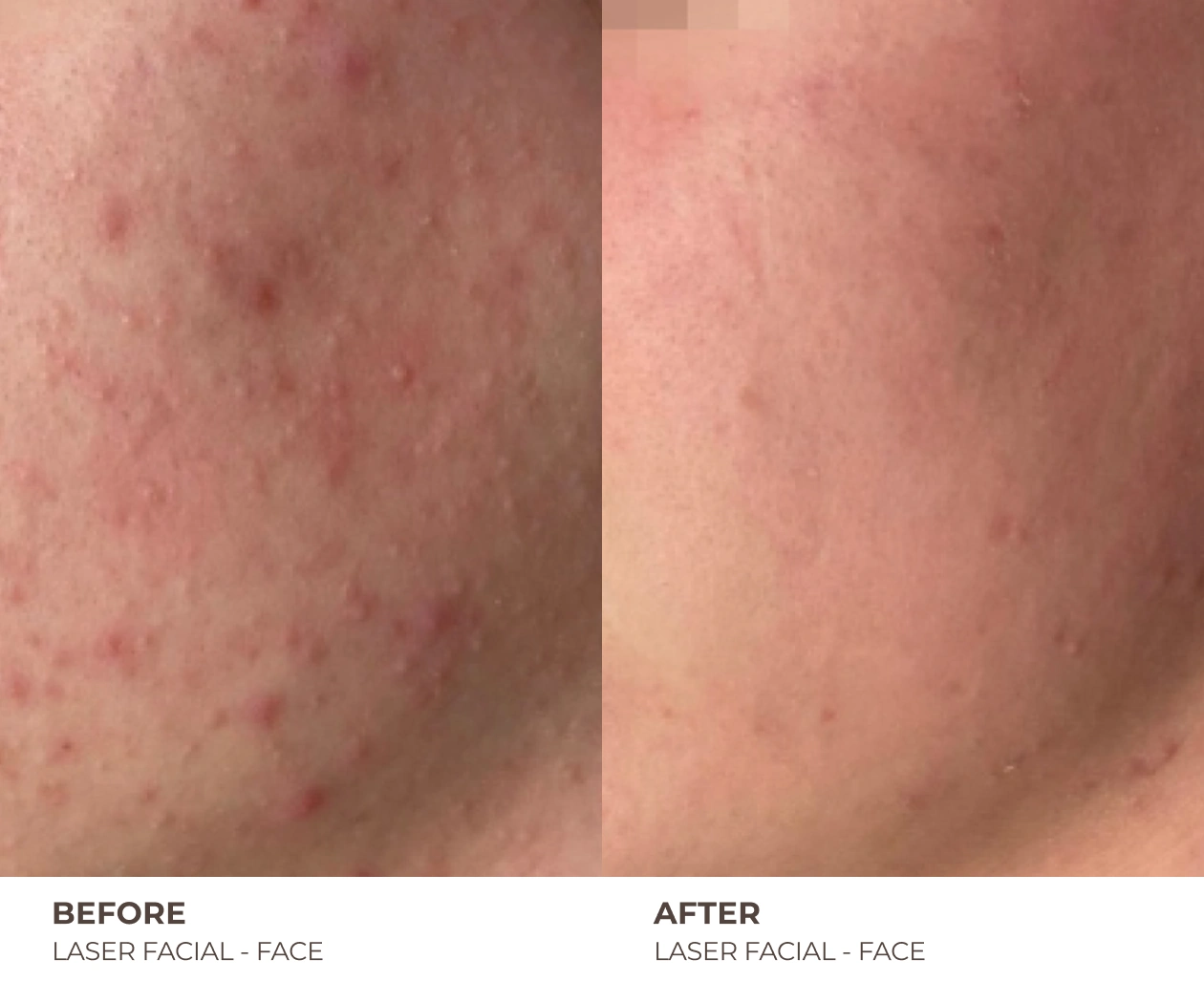 B&A_HOMEPAGE_06