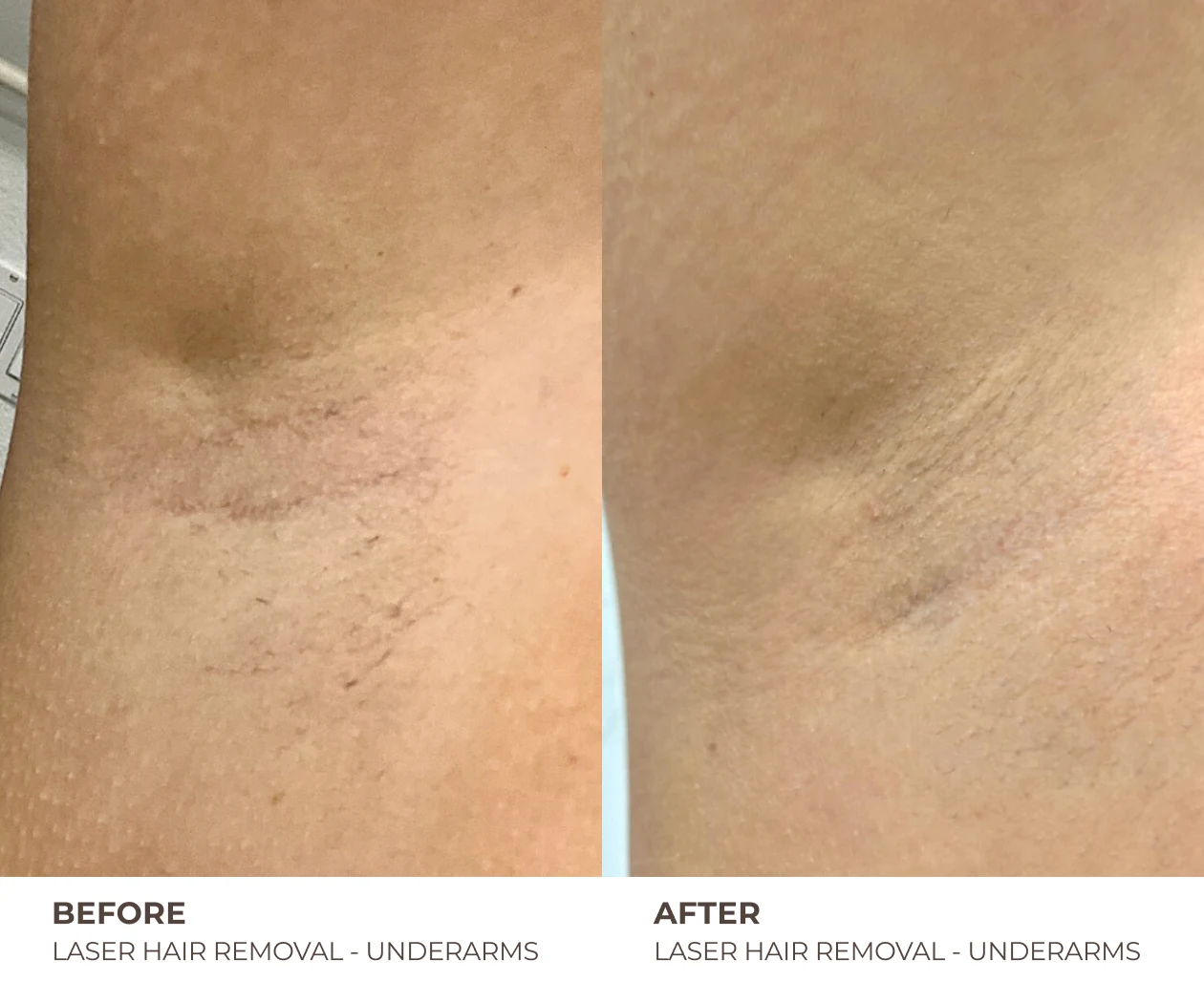 B&A_HOMEPAGE_11