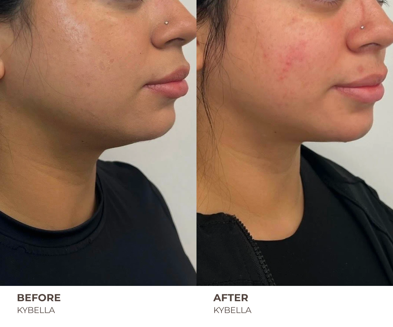 B&A_HOMEPAGE_12