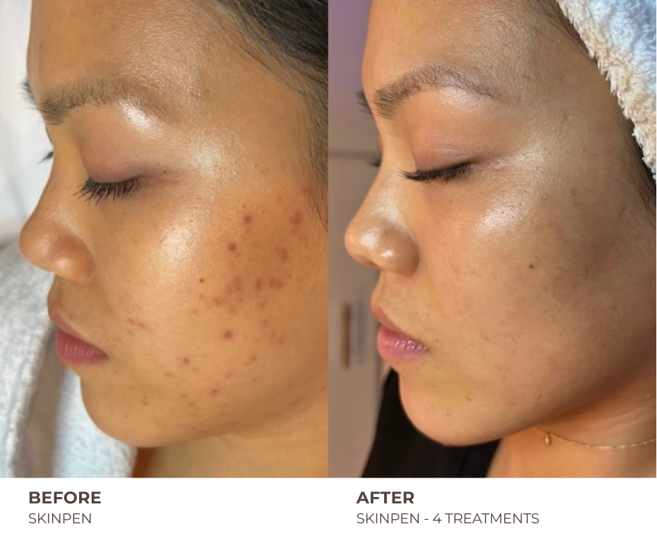 B&A_HOMEPAGE_13