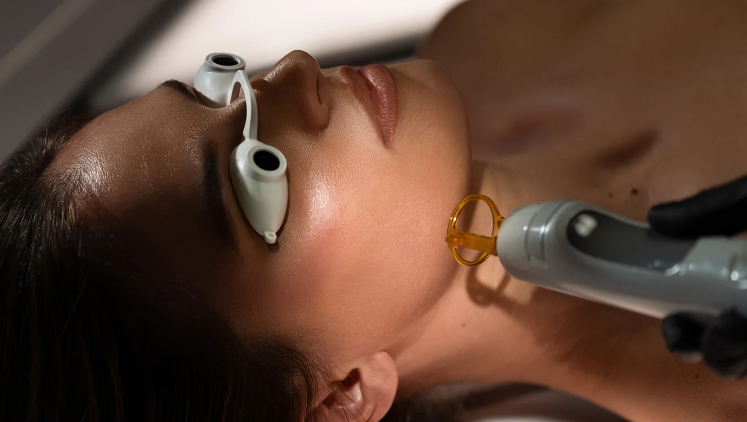 laser facial in SEV Alexandria