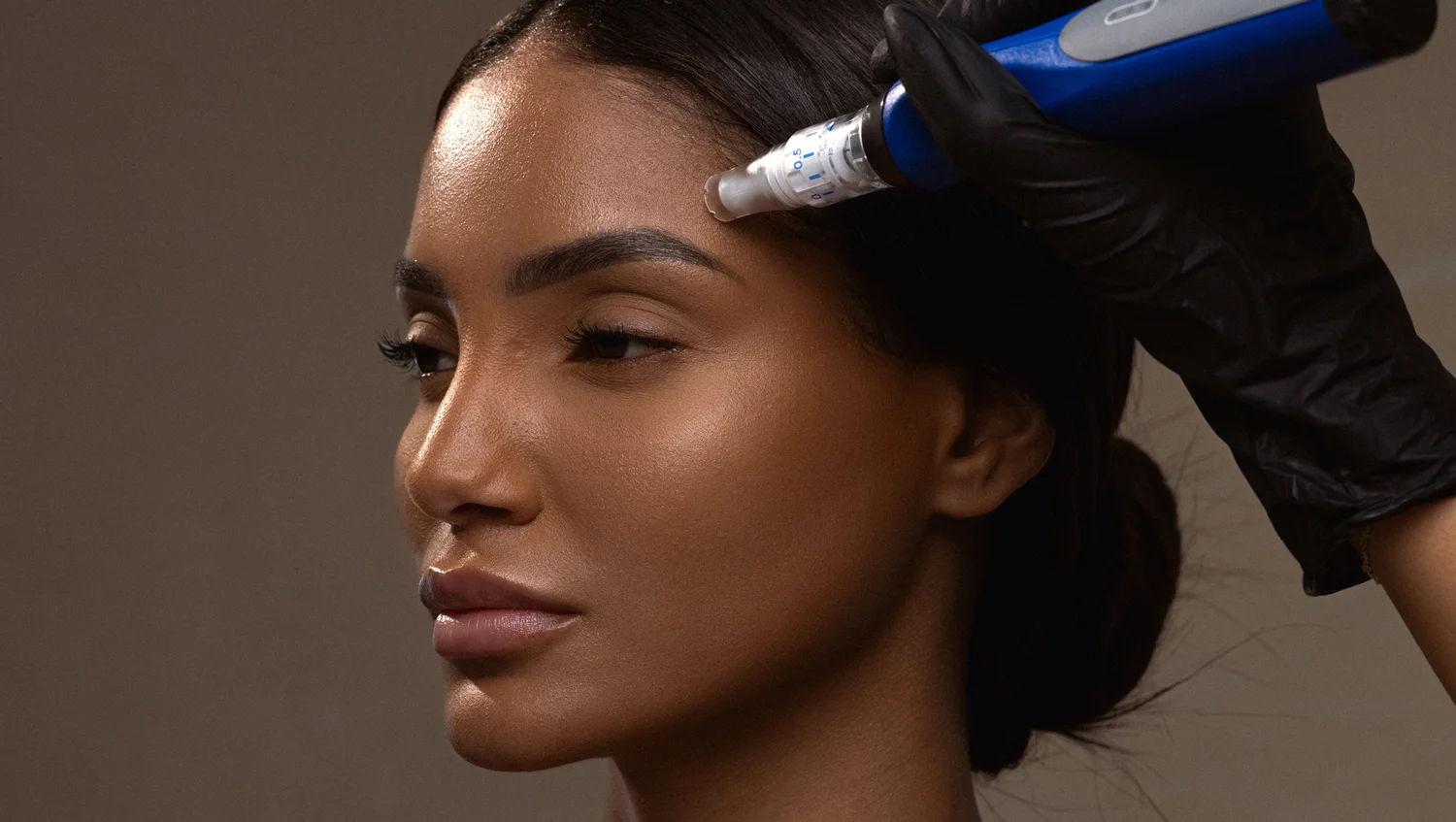 skinpen microneedling in SEV Frisco