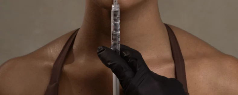 How Long After Lip Filler Can You Kiss​?