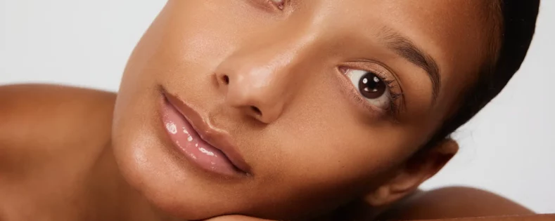 Microneedling for Acne Scars