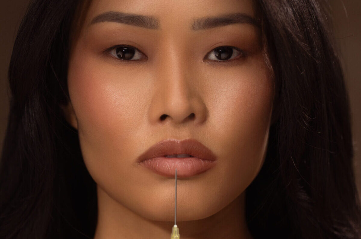 Types of Lip Fillers: Complete Guide to Natural Results