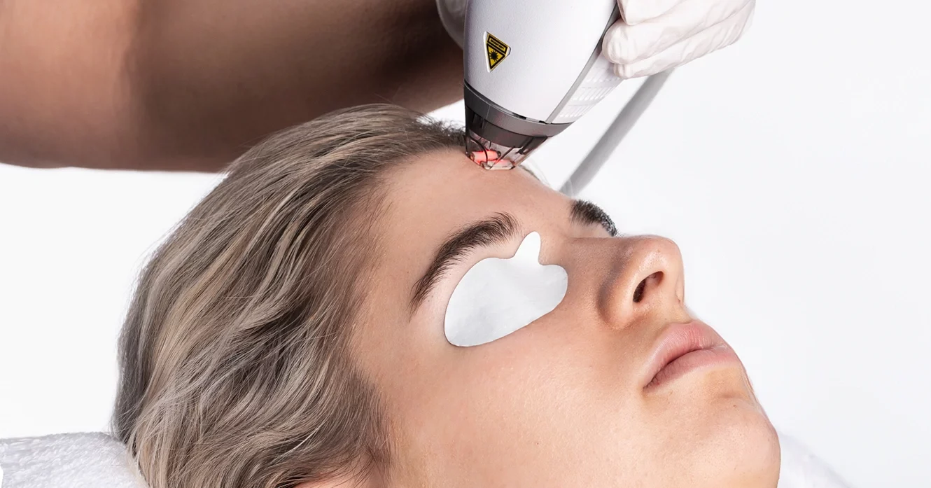 Clear + Brilliant® Laser Treatment Guide