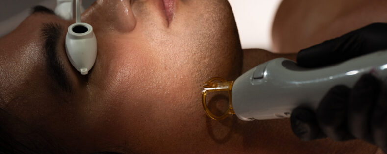 How Much Does a Laser Facial Cost in 2026?